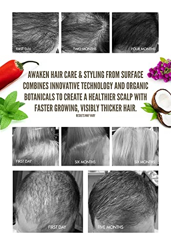 Foto 3 pulgar | Shampoo Surface Hair Awaken Therapeutic 1l - Venta Internacional