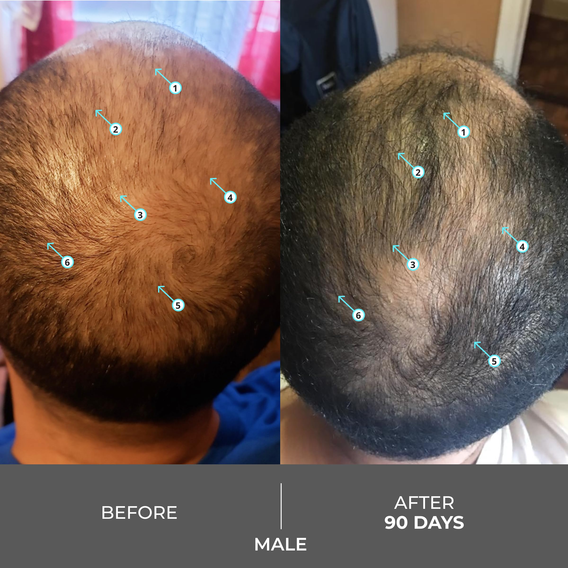 Foto 6 pulgar | Champú Ds Laboratories Revita Extra Strength Hair Growth - Venta Internacional