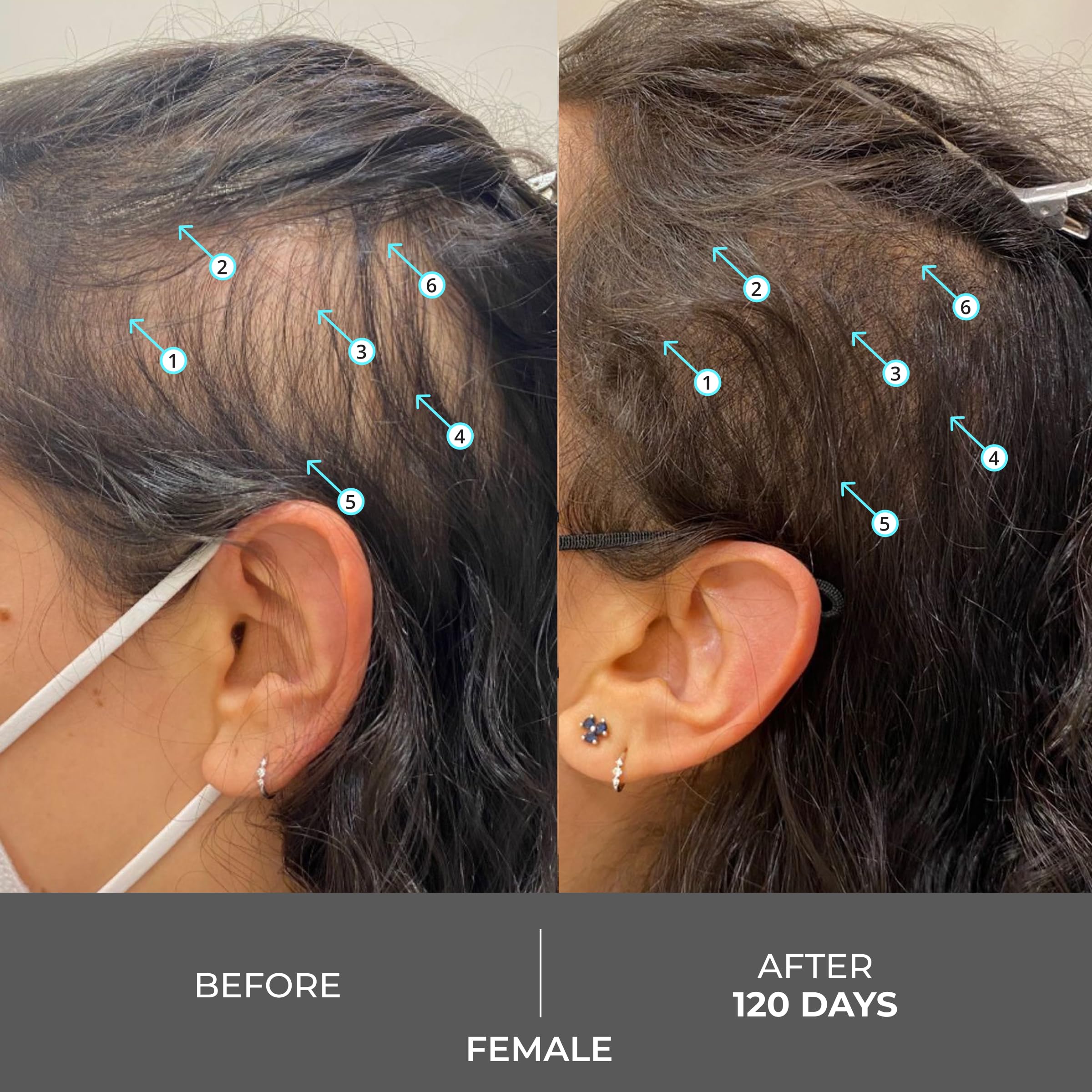 Foto 7 pulgar | Champú Ds Laboratories Revita Extra Strength Hair Growth - Venta Internacional