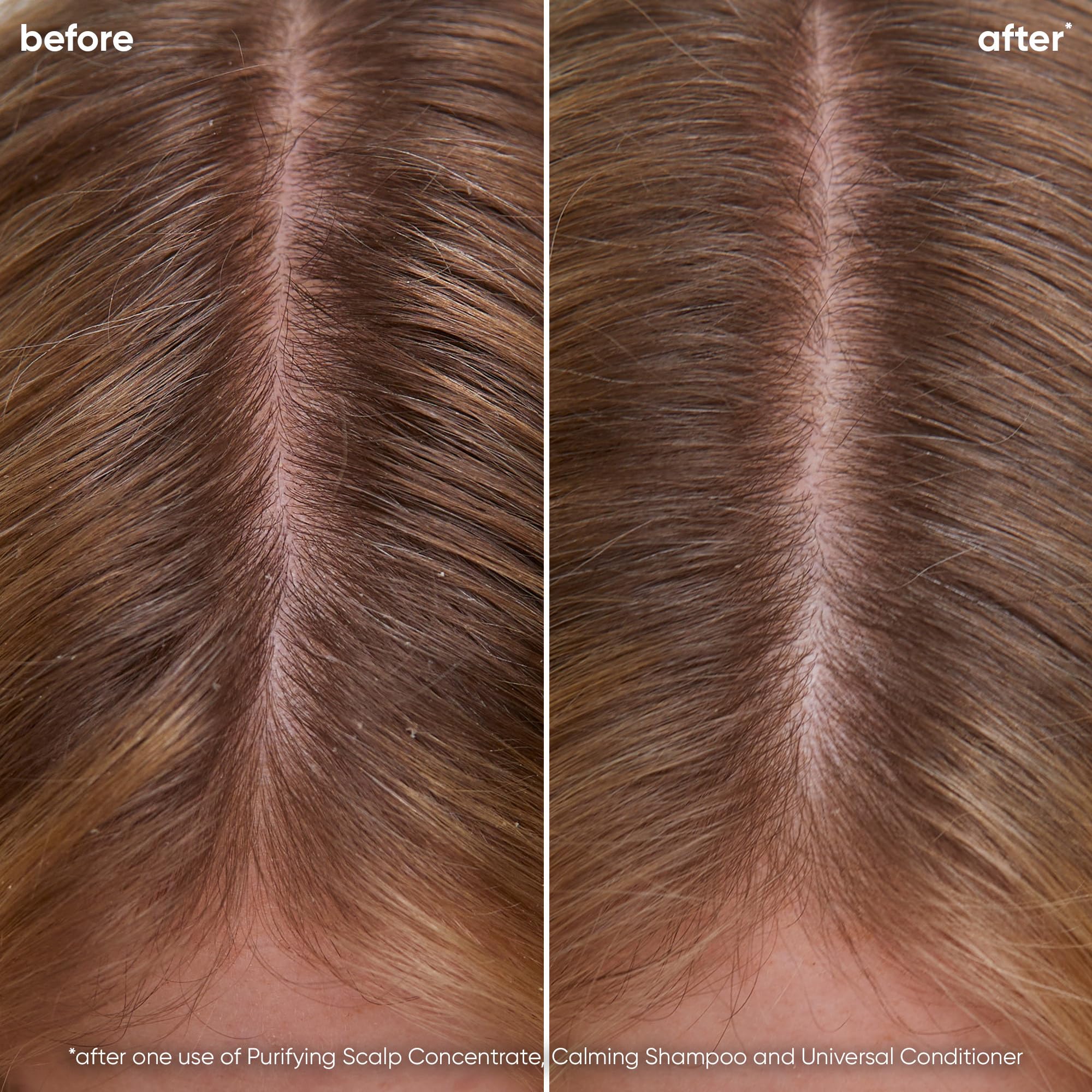 Foto 3 pulgar | Shampoo Biolage Scalp Sync Calming Que Calma E Hidrata El Cuero Cabelludo - Venta Internacional