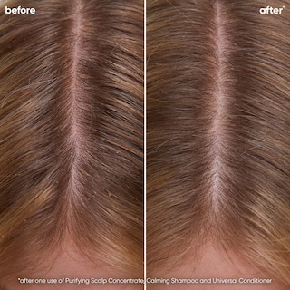 Foto 2 | Shampoo Biolage Scalp Sync Calming Que Calma E Hidrata El Cuero Cabelludo - Venta Internacional