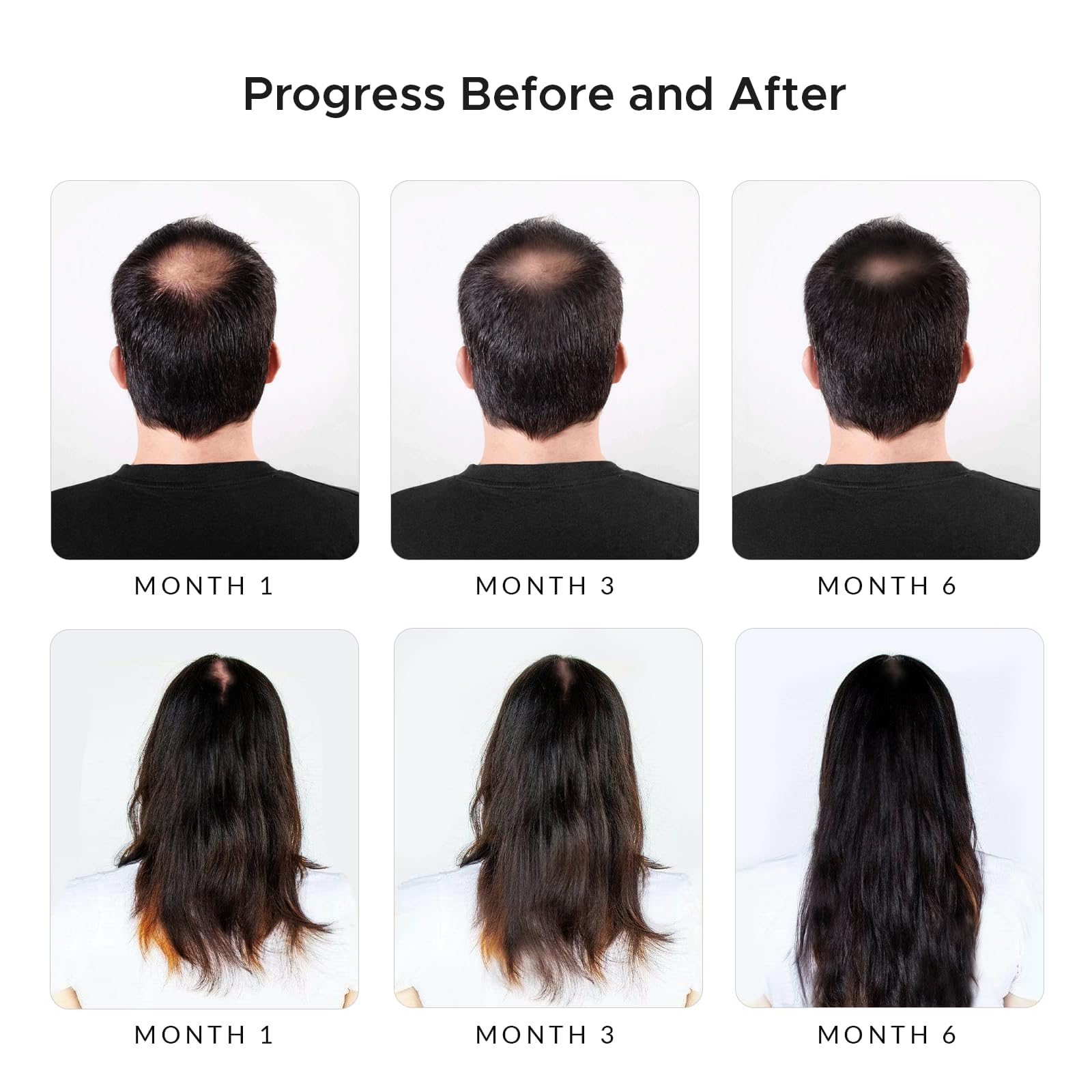 Foto 3 pulgar | Champú Rivermint Con Ácido Hialurónico Y Biotina Para El Crecimiento Del Cabello - Venta Internacional.