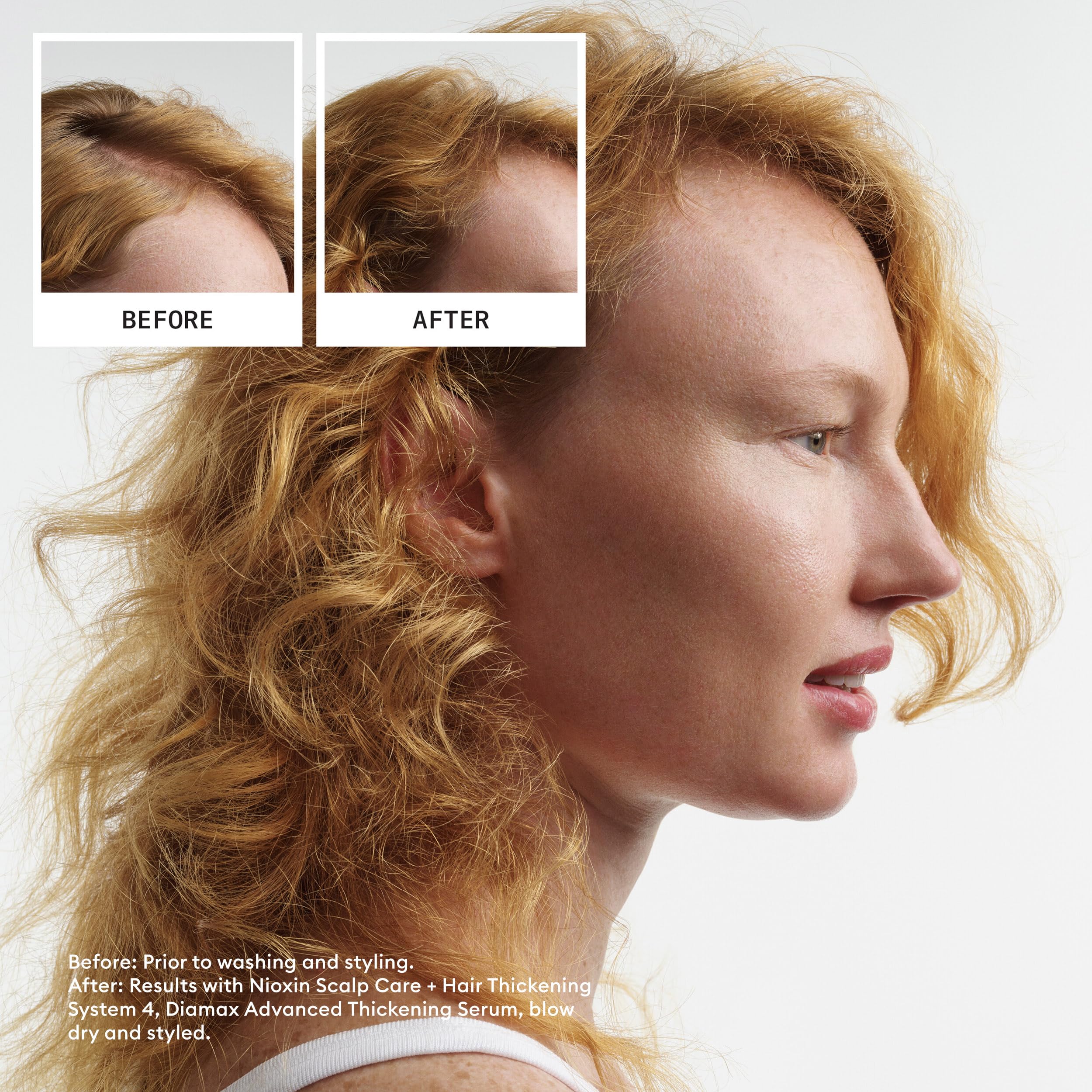 Foto 3 | Champú Nioxin System 4 Para Espesar El Cuero Cabelludo Y El Cabello, 1 Litro - Venta Internacional.