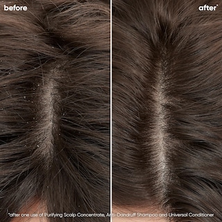 Foto 2 | Champú Biolage Scalp Sync Anticaspa Anticaspa Control - Venta Internacional.