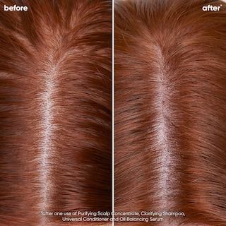 Foto 3 | Champú Biolage Scalp Sync Clarifying Vegan Para Cabello Graso - Venta Internacional.