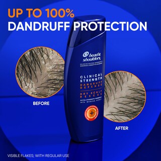 Foto 6 | Champú Head & Shoulders Clinical Dandruff Defense + Dry Scalp Rescue 400 Ml X2 - Venta Internacional.