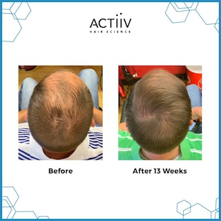 Foto 3 | Champú Actiiv Recover, Limpiador Y Espesante Para La Caída Del Cabello, 480 Ml, Para Hombres - Venta Internacional.