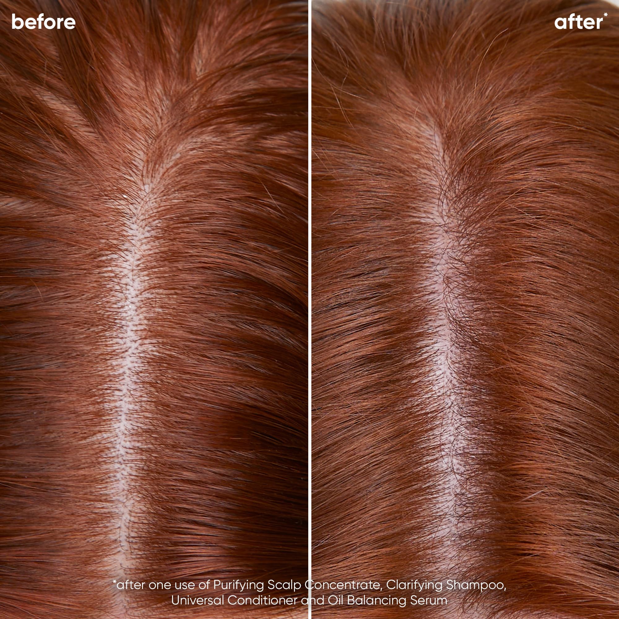 Foto 4 pulgar | Champú Biolage Scalp Sync Clarifying Vegan Para Cabello Graso - Venta Internacional.