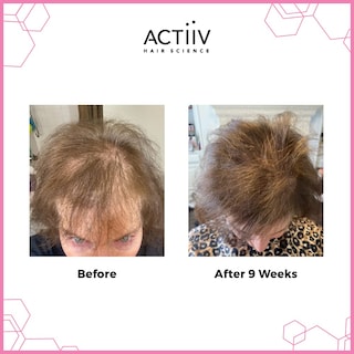 Foto 3 | Champú Actiiv Recover, Limpiador Y Espesante Para La Caída Del Cabello, 480 Ml - Venta Internacional.