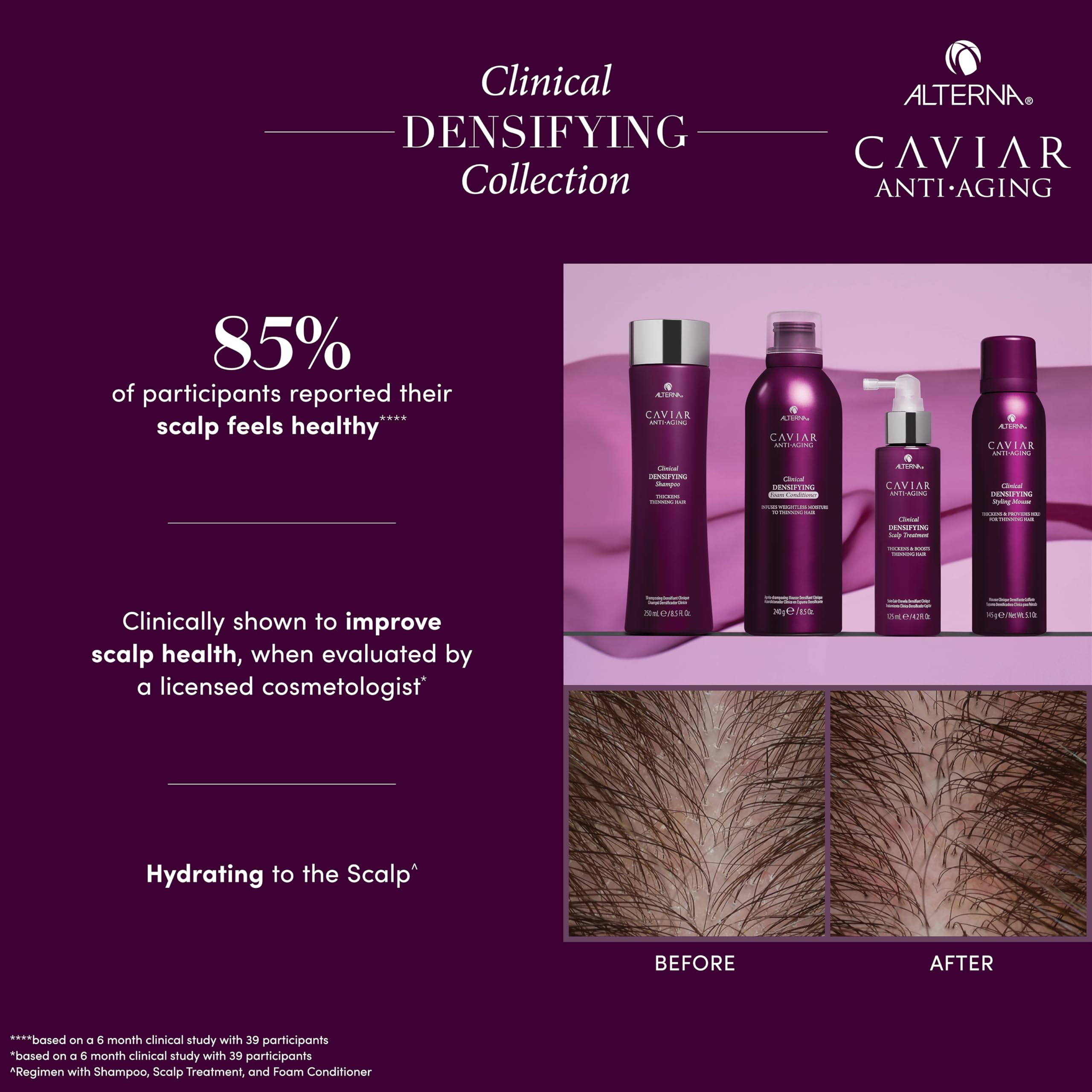 Foto 4 pulgar | Champú Alterna Caviar Antiedad Clínico Densificante 250 Ml - Venta Internacional.