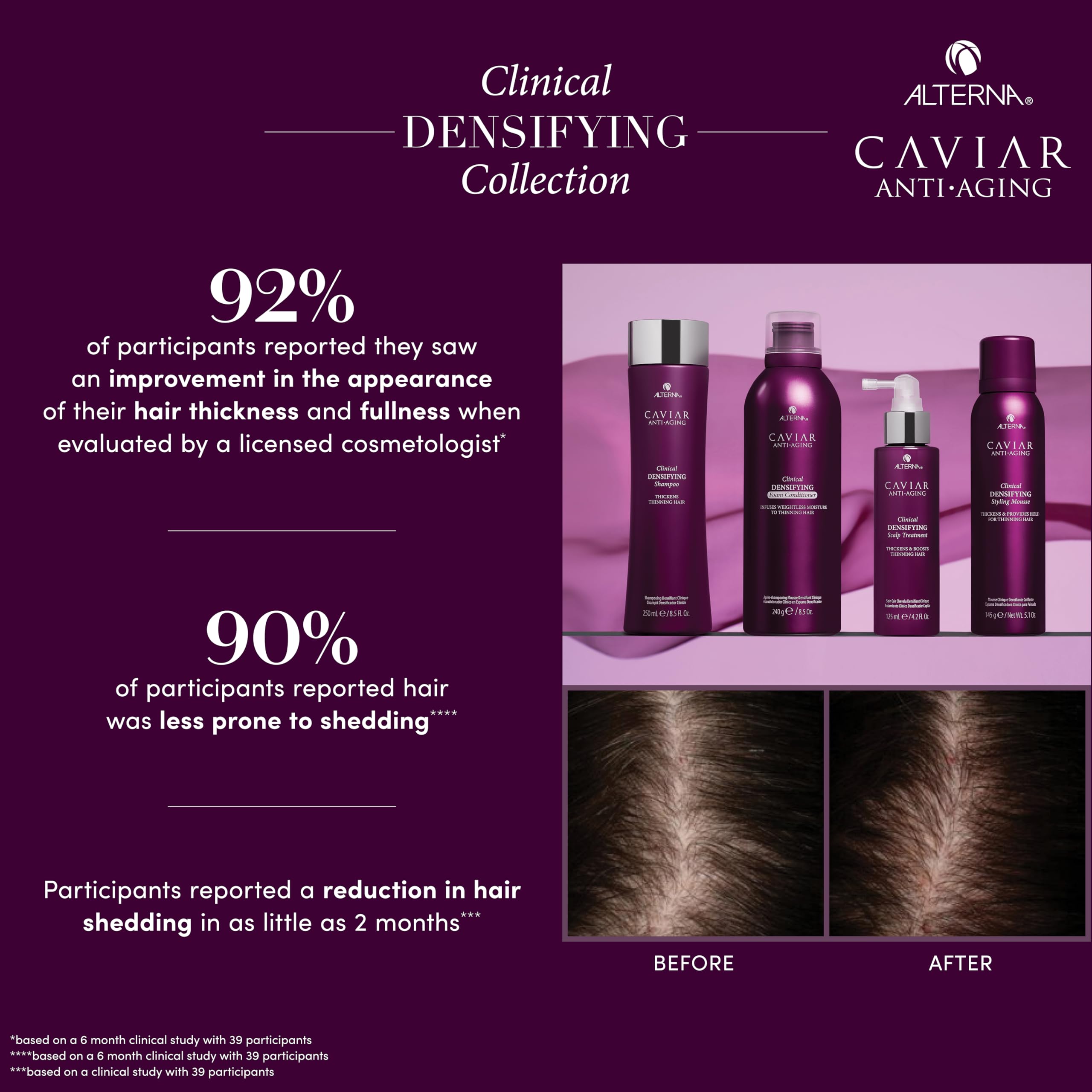 Foto 5 pulgar | Champú Alterna Caviar Antiedad Clínico Densificante 250 Ml - Venta Internacional.