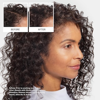 Foto 4 | Champú Nioxin Hair Fall Defense Activa Los Folículos Pilosos, 1 Litro - Venta Internacional.