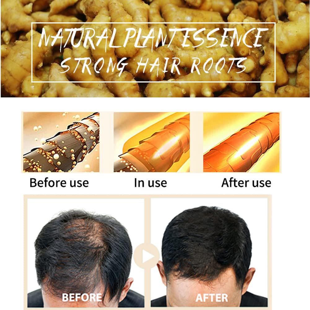 Foto 7 pulgar | Champú En Barra Maiting Natural Ginger Hair Recrowth, 3 Unidades - Venta Internacional.