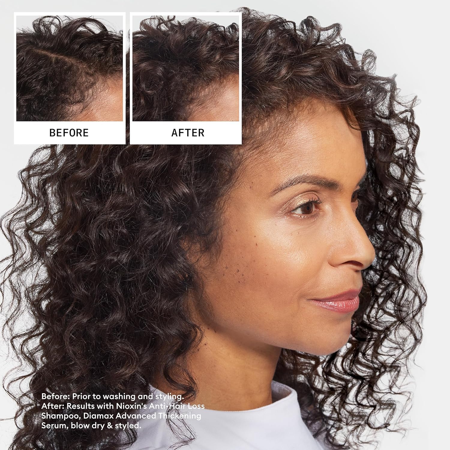 Foto 5 pulgar | Champú Nioxin Hair Fall Defense Activa Los Folículos Pilosos 240 Ml - Venta Internacional.