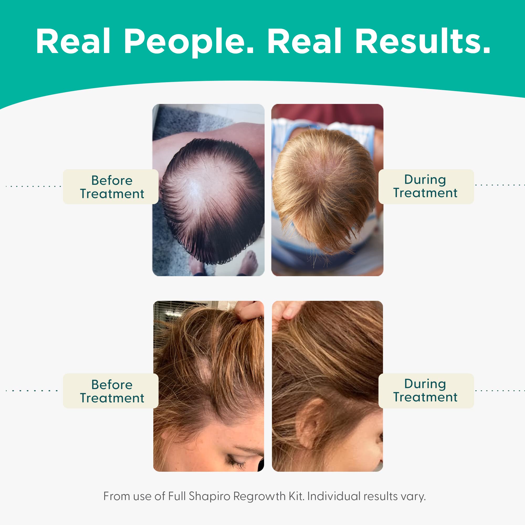 Foto 6 pulgar | Shampoo con Acondicionador Shapiro MD Hair Growth Experts de 235 ml-Venta Internacional
