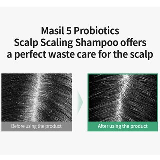 Foto 4 | Shampoo Masil 5 Probiotics Scalp Scalp Scalp Pack, Paquete De Viaje De 20 Ml - Venta Internacional.