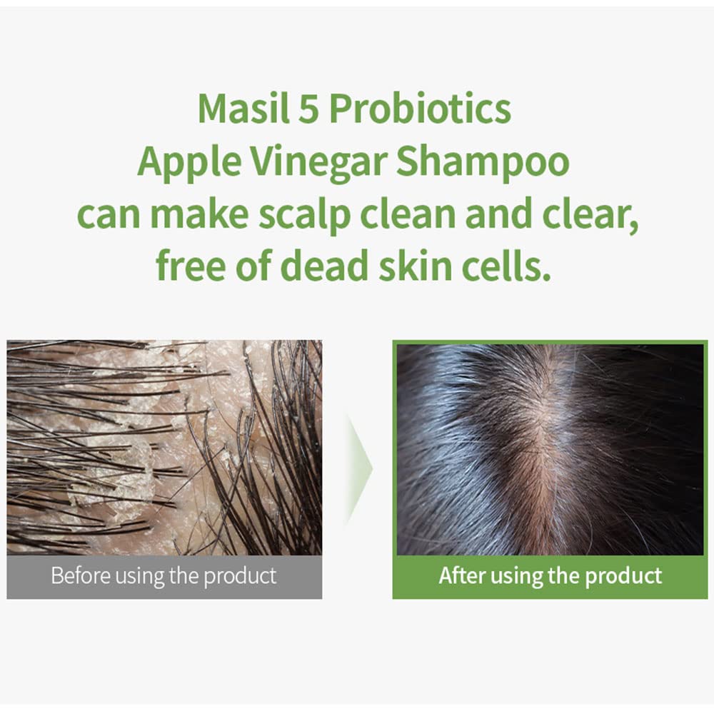 Foto 5 pulgar | Champú Masil 5 Probiotics, Vinagre De Sidra De Manzana, 300 Ml X 20 - Venta Internacional.