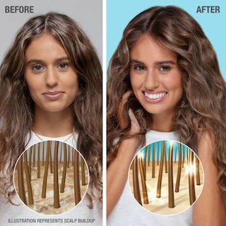 Foto 3 | Champú Neutrogena Healthy Scalp Hydro Boost 360 Ml Para Cabello Seco - Venta Internacional.