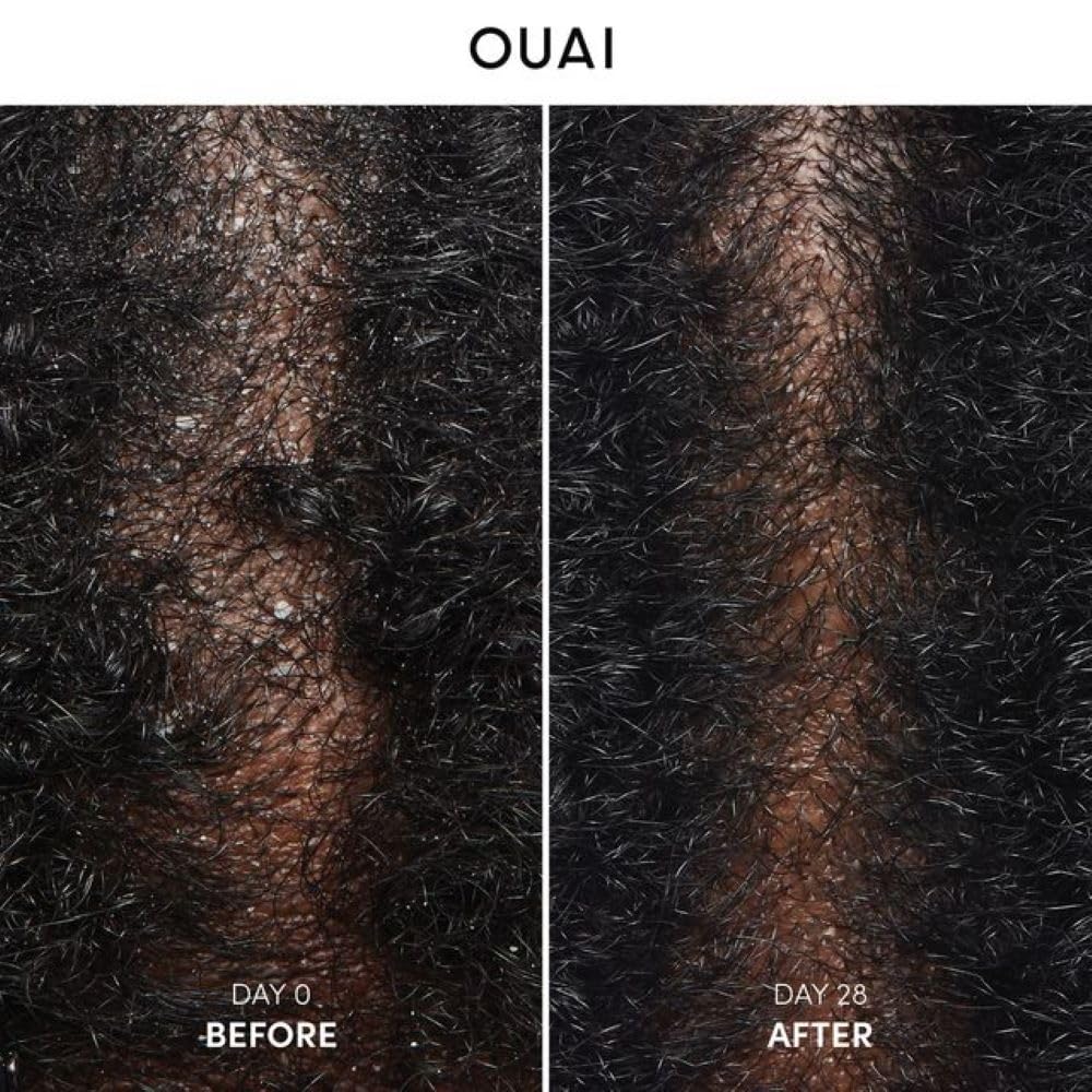 Foto 2 | Champú Ouai Anticaspa Con Ácido Salicílico Calmante 300 Ml - Venta Internacional.