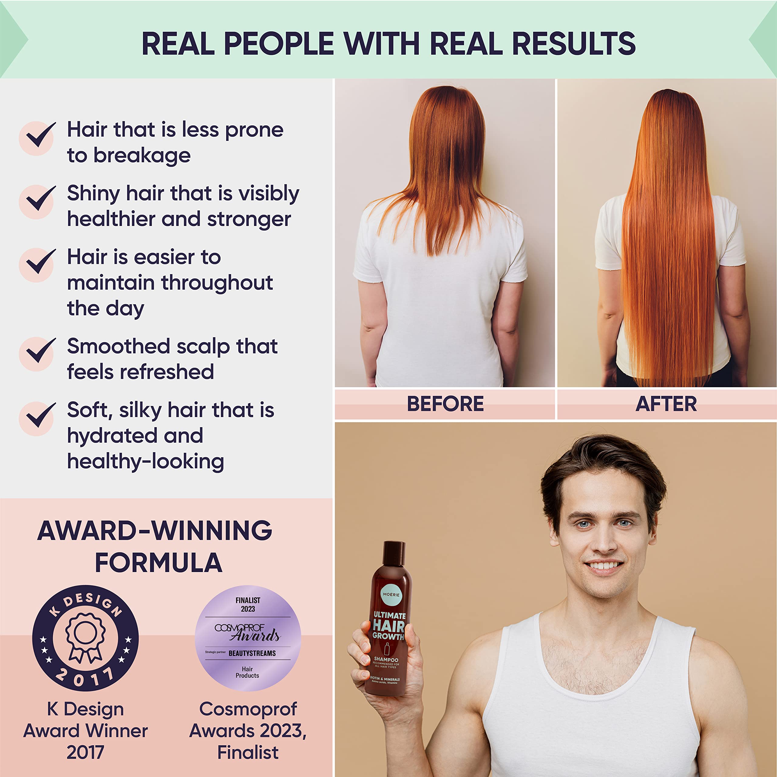 Foto 6 pulgar | Champú M Moérie Moerie Ultimate Hair Growth 250 Ml, Vegano - Venta Internacional.