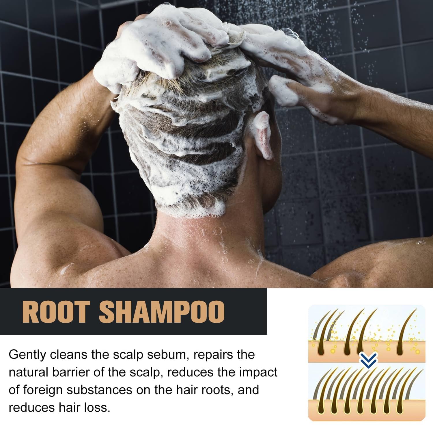 Foto 3 pulgar | Champú Root Activator Para El Crecimiento Del Cabello Y Anticaída, 2 Unidades - Venta Internacional.