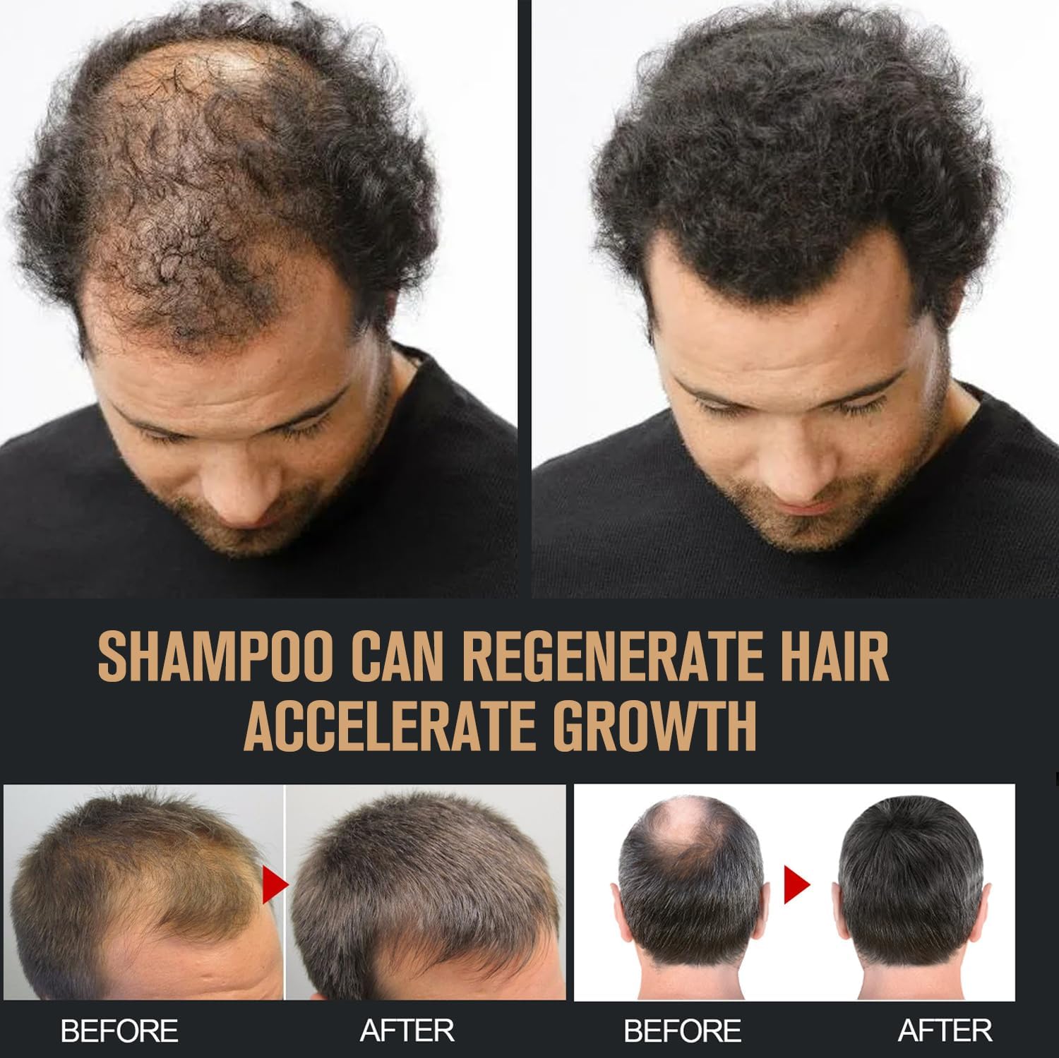 Foto 5 pulgar | Champú Root Activator Para El Crecimiento Del Cabello Y Anticaída, 2 Unidades - Venta Internacional.