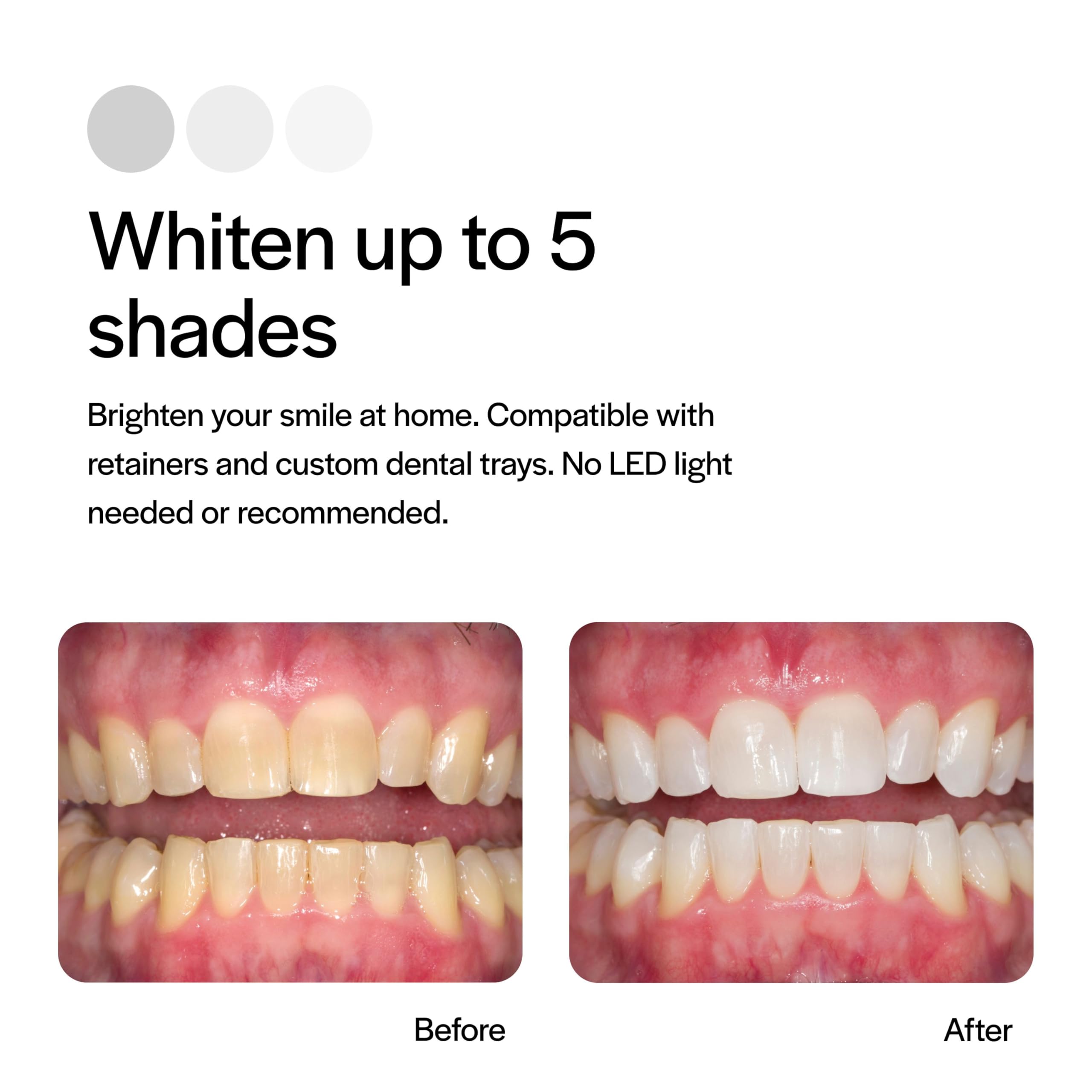 Foto 4 | Jeringas De Gel Para Blanquear Los Dientes Opalescence  Kit De Recarga Al 35%  X8 - Venta Internacional.