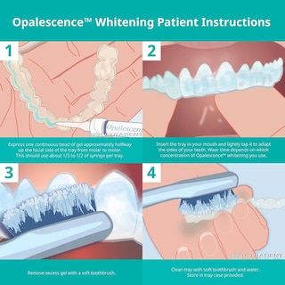 Foto 5 | Jeringas De Recambio Para Blanqueamiento Dental Opalescence 20% Con Pf - Venta Internacional.