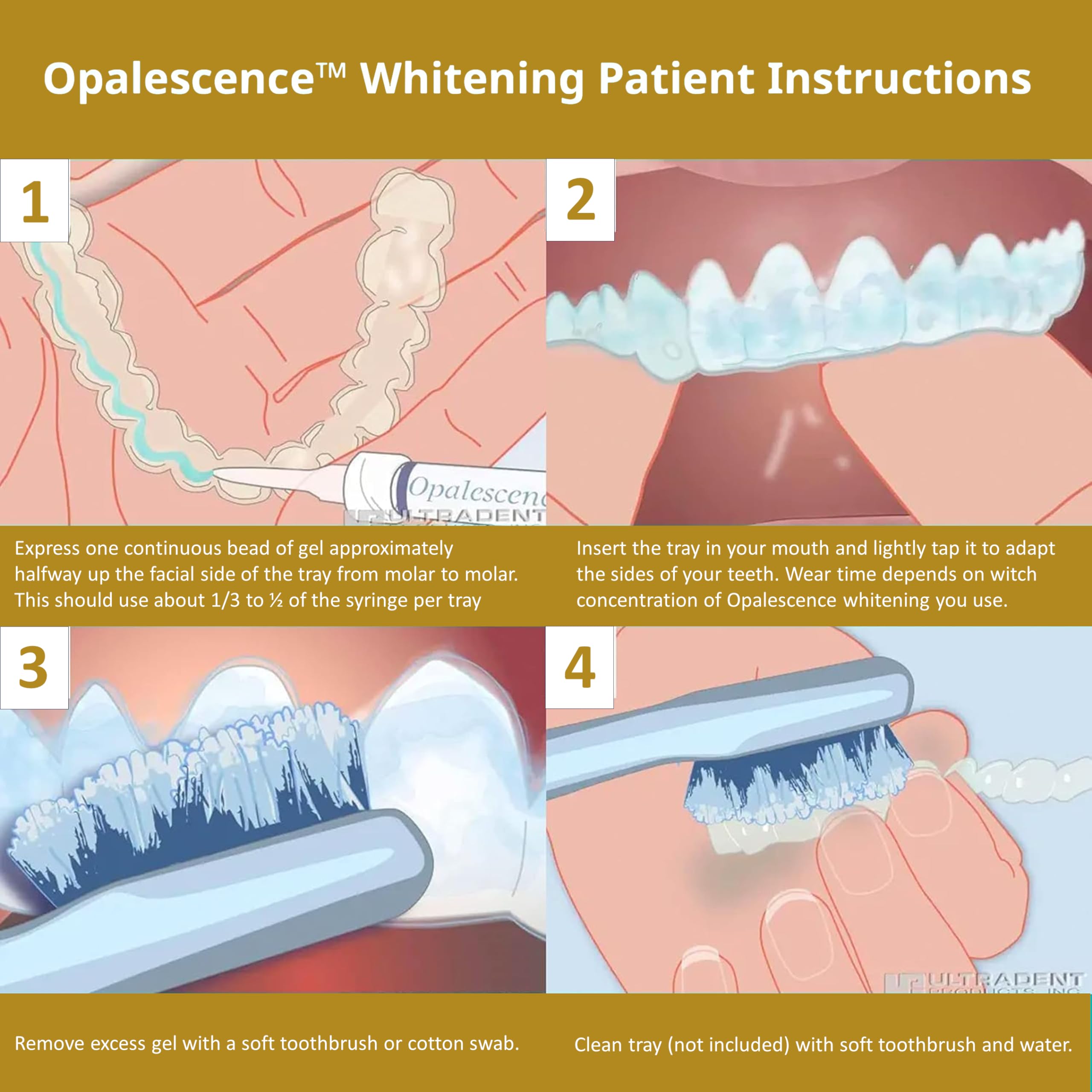 Foto 7 pulgar | Jeringas De Gel Blanqueadoras De Dientes Opalescence Quick Pf 45% (12) - Venta Internacional.