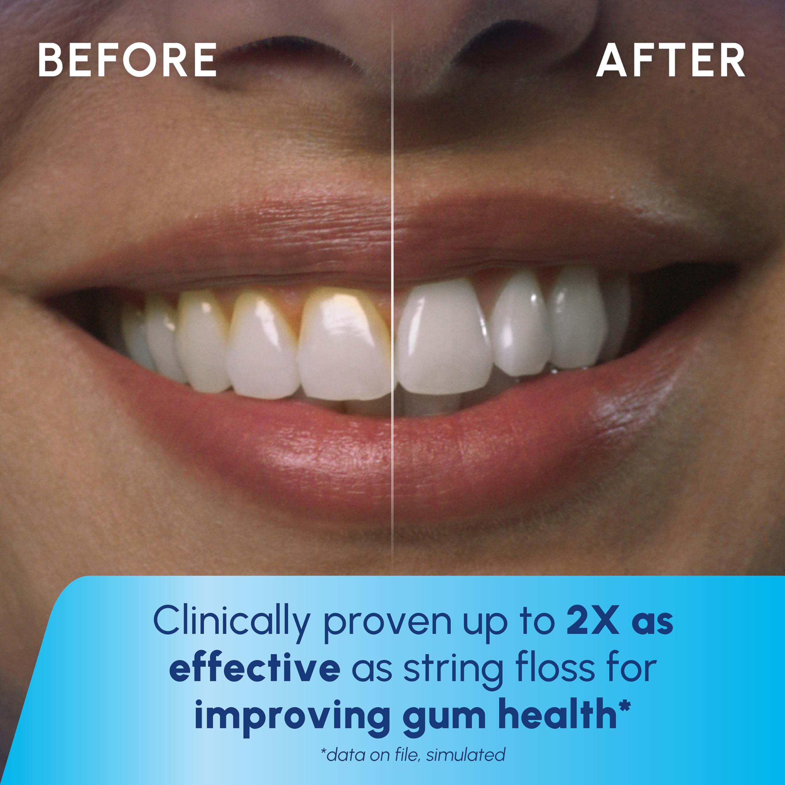 Foto 5 | Irrigador Dental Waterpik Cordless Pulse Recargable Blanco- Venta Internacional