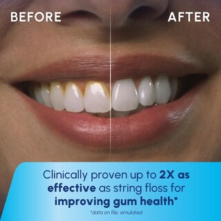 Foto 5 | Irrigador Dental Waterpik Cordless Pulse Recargable Blanco- Venta Internacional