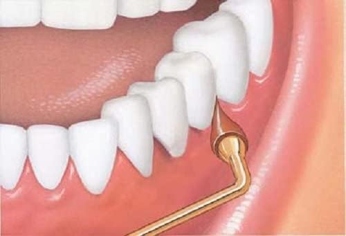 Foto 4 pulgar | El Estimulador Gum Rellena 3 Puntas De Goma Para Un Agarre Permanente - Venta Internacional.