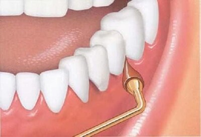 Foto 3 | El Estimulador Gum Rellena 3 Puntas De Goma Para Un Agarre Permanente - Venta Internacional.