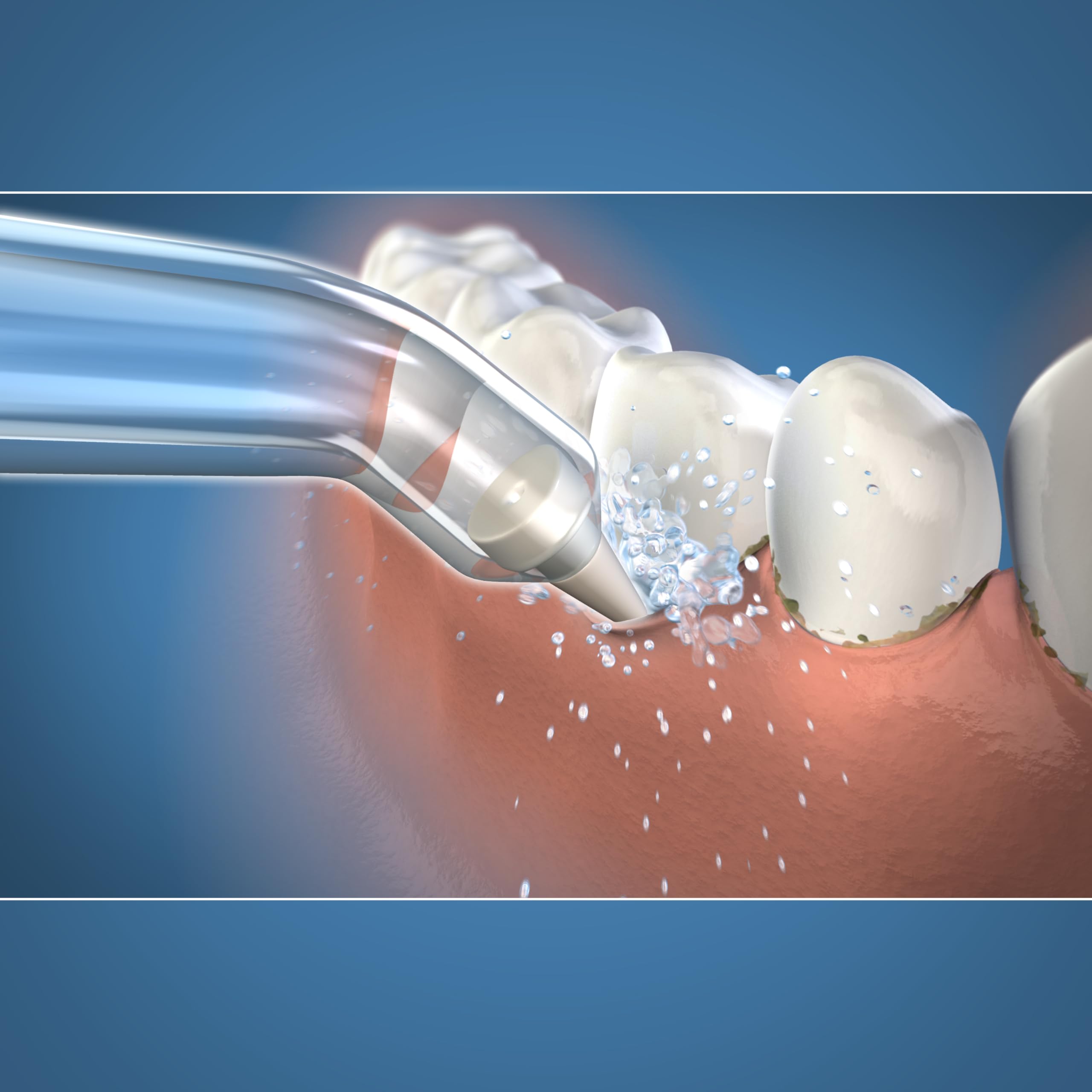 Foto 4 | Consejos Para Reemplazar El Hilo Dental Waterpik Pink Pocket Pp-100e - Venta Internacional.