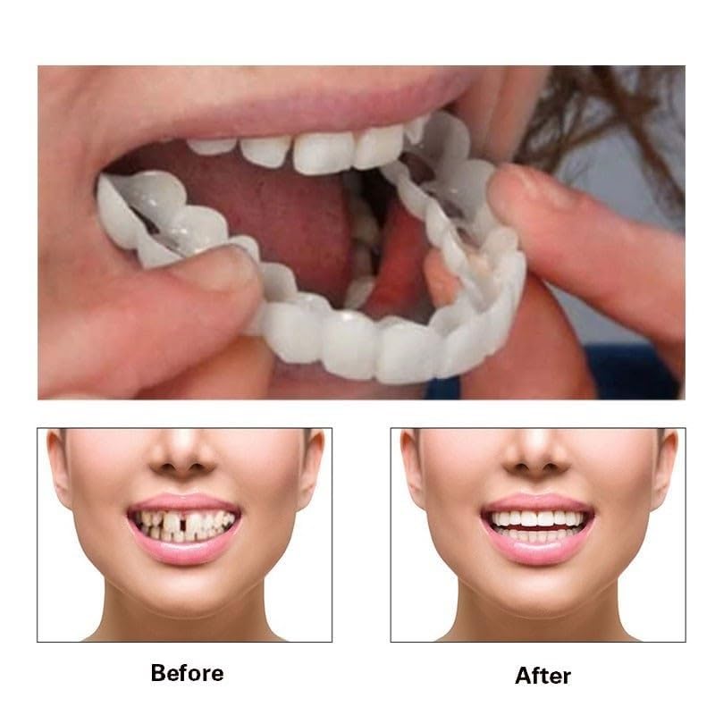 Foto 3 pulgar | Dos Pares De Dentaduras Ajustables Para Hombres Y Mujeres - Venta Internacional.