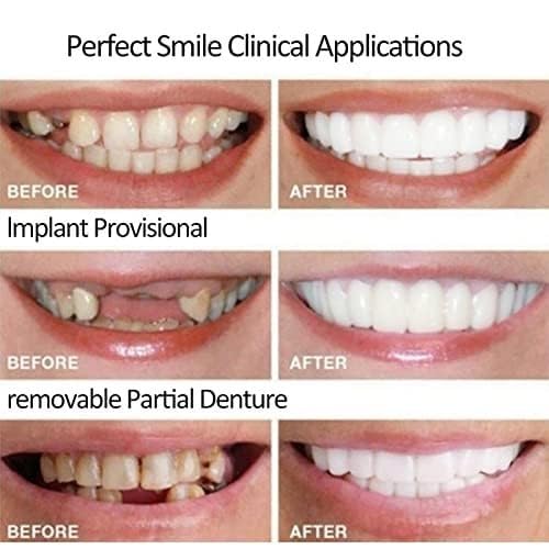 Foto 5 pulgar | Dos Pares De Dentaduras Ajustables Para Hombres Y Mujeres - Venta Internacional.