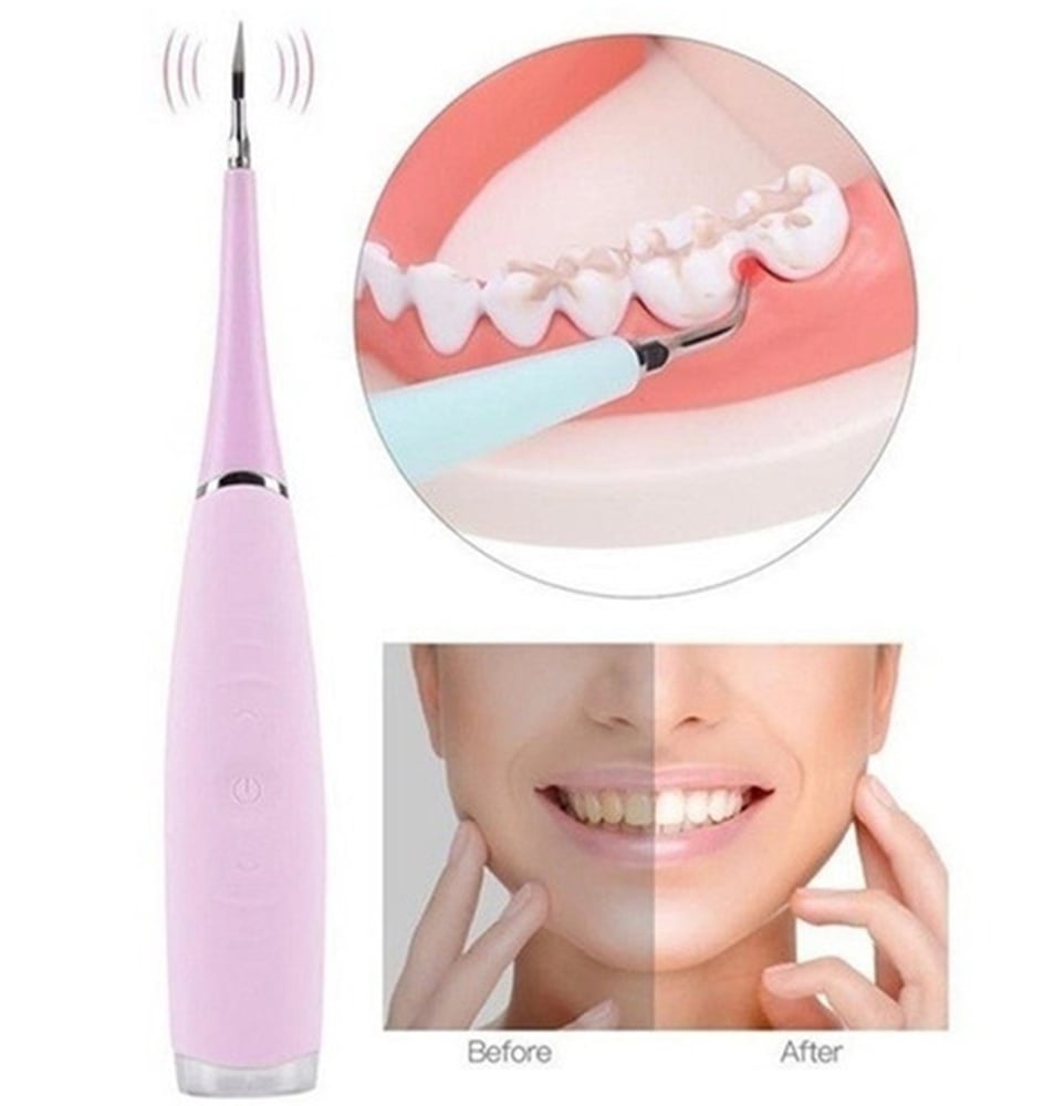 Foto 4 pulgar | Eliminador De Sarro Dental Limpiador De Dientes Sarro Removal Ipx6 - Venta Internacional.