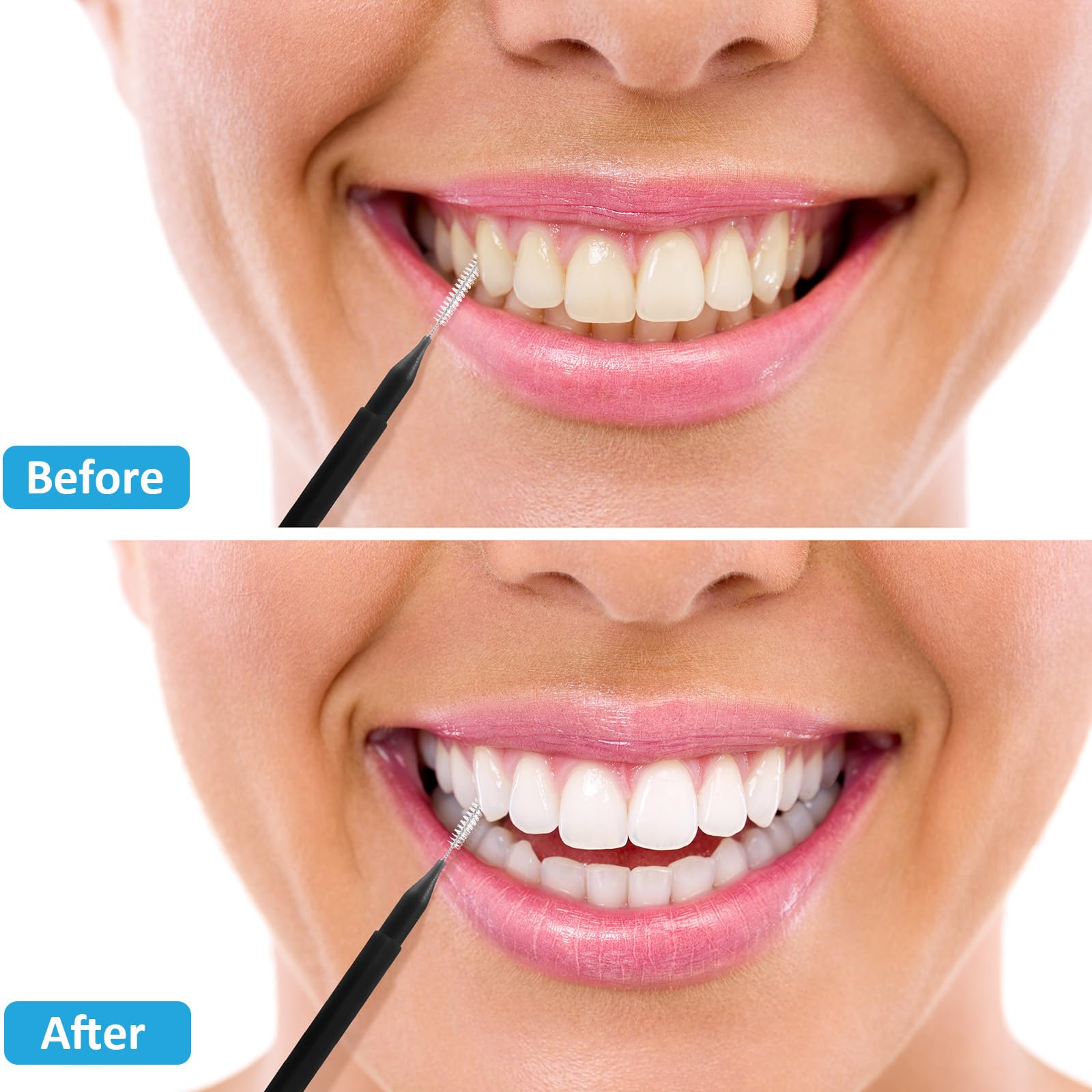 Foto 7 pulgar | Cepillo Interdental Patelai, 100 Piezas, Hilo Dental - Venta Internacional.
