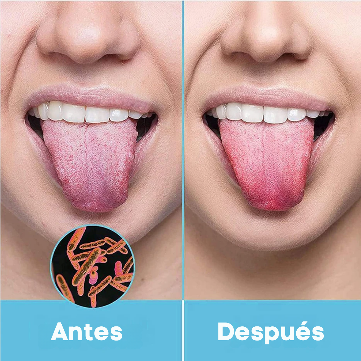 Foto 6 | Limpiador Lingual Acero Inoxidable Gran Calidad Limpieza Lengua Bucal