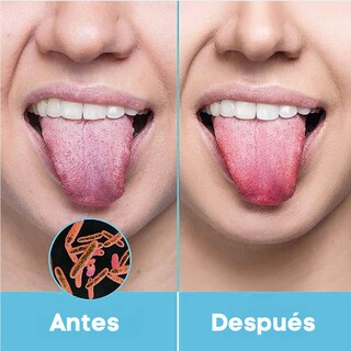 Foto 6 | Limpiador Lingual Acero Inoxidable Gran Calidad Limpieza Lengua Bucal
