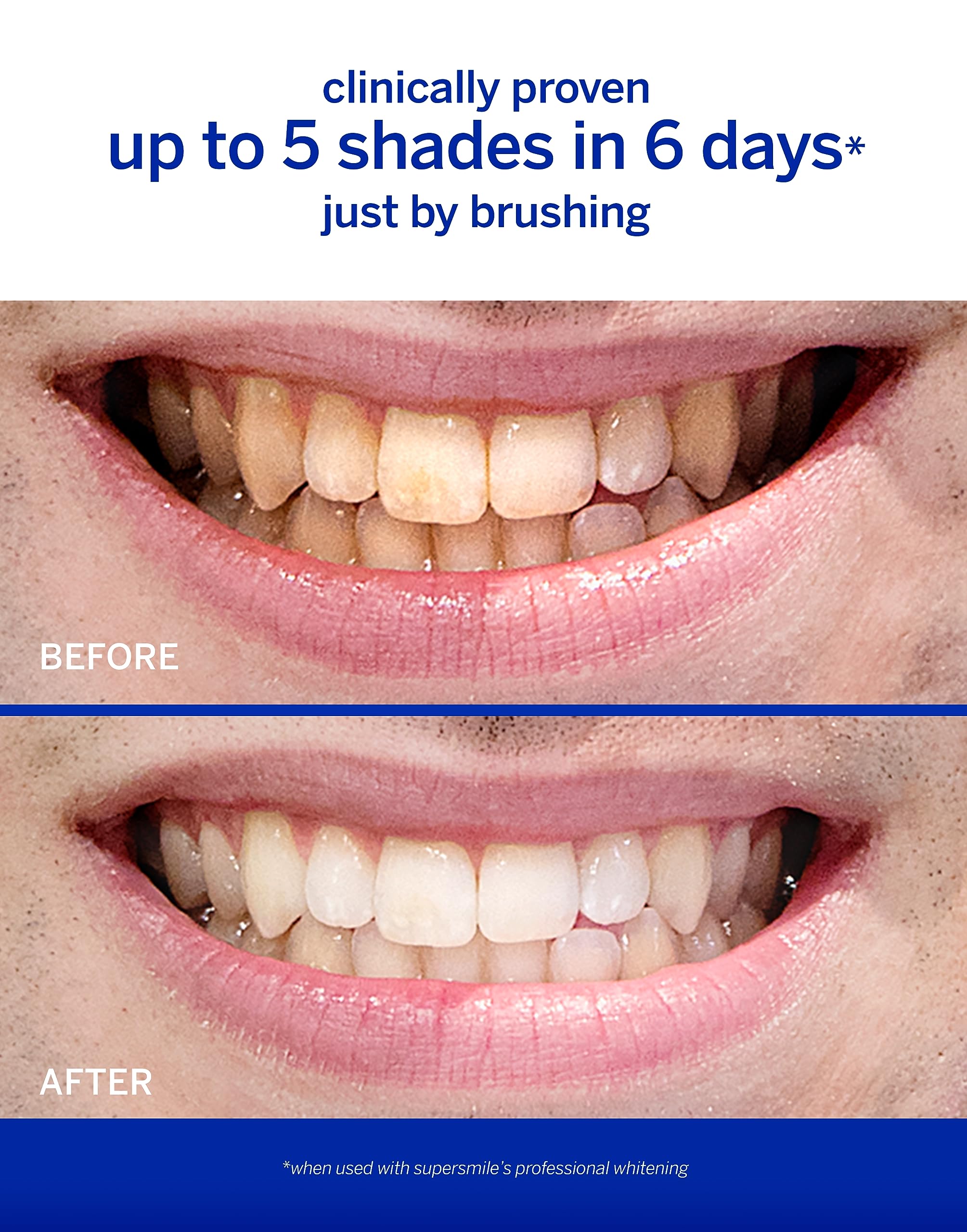Foto 3 | Pasta de Dientes Supersmile Professional 240 ml - Venta Internacional