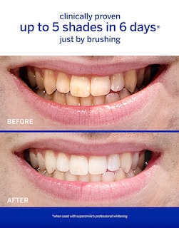 Foto 3 | Pasta de Dientes Supersmile Professional 240 ml - Venta Internacional