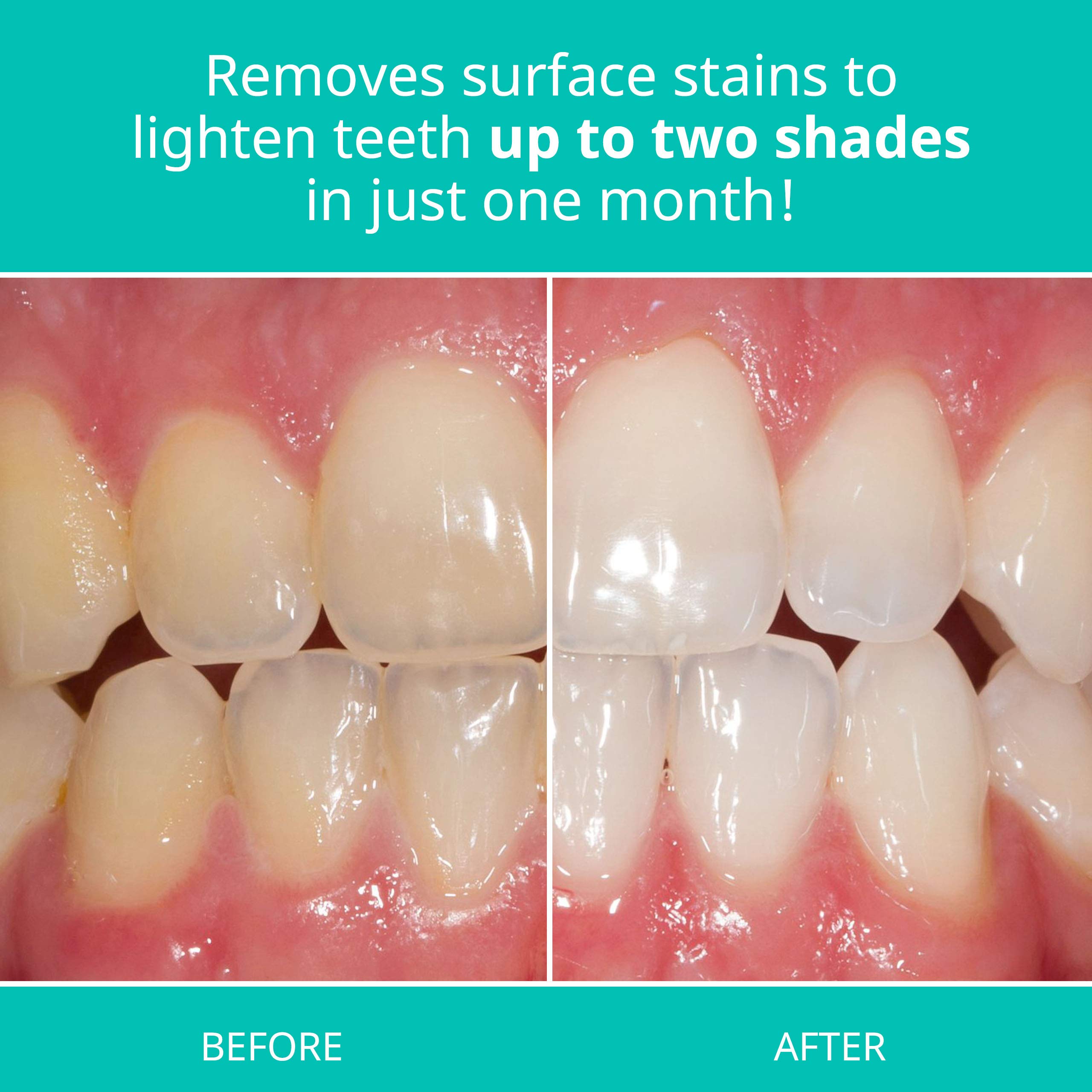 Foto 6 | Pasta De Dientes Blanqueadora Con Opalescencia Para Dientes Sensibles, 90 Ml, Paquete De 3 - Venta Internacional.