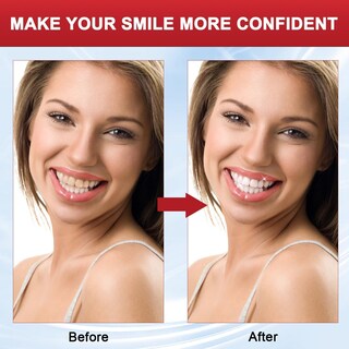 Foto 5 | Pasta de Dientes Wesun Super Probiotic SP-8 Ultra Whitening - Venta Internacional
