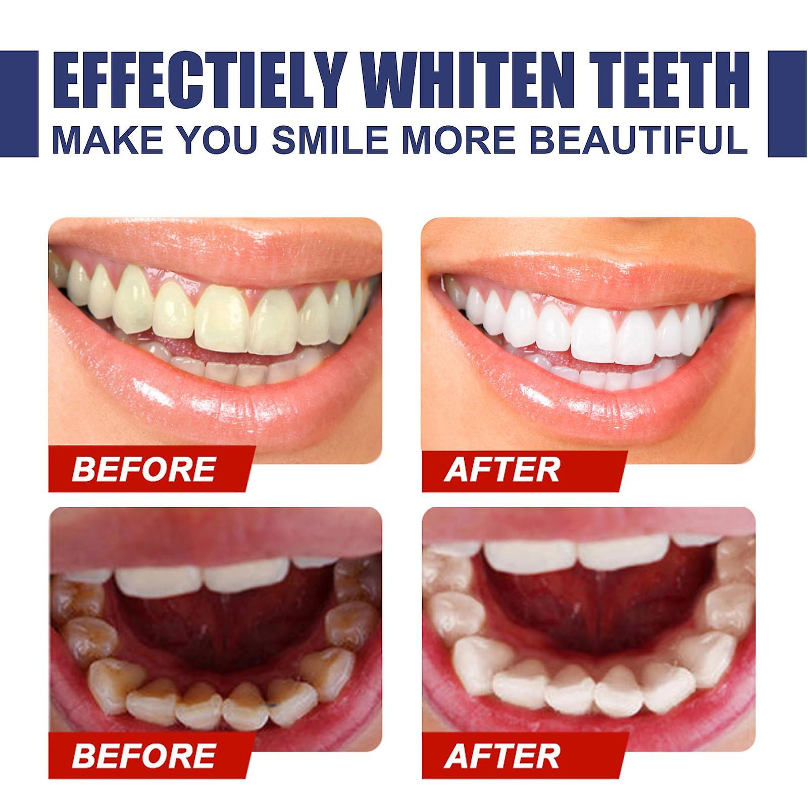 Foto 4 | Pasta De Dientes Huoguo Descontaminante Blanqueadora 30ml - Venta Internacional.
