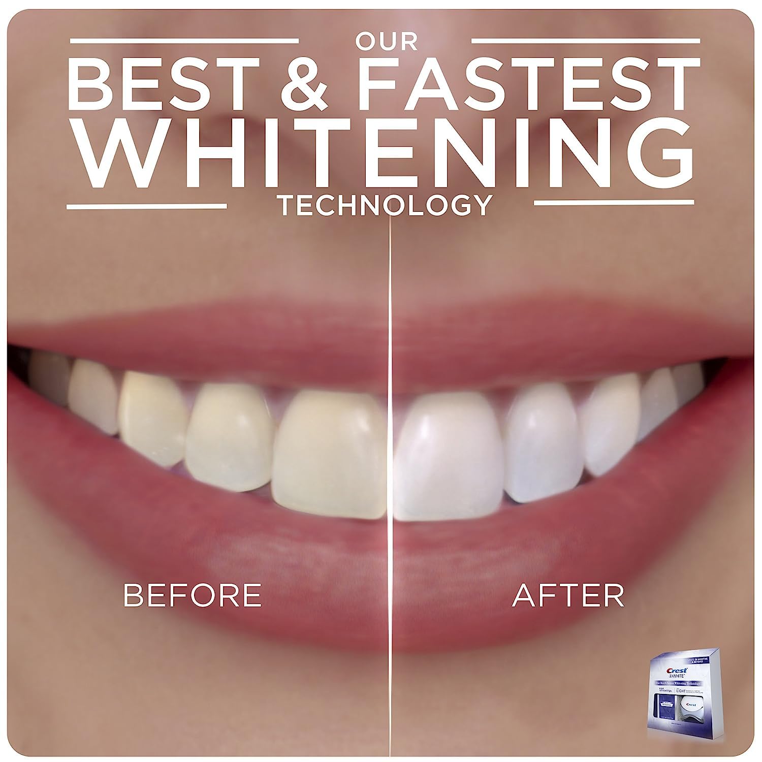 Foto 5 | Kit De Tiras Blanqueadoras De Dientes Crest 3d Whitestrips Con Luz - Venta Internacional.