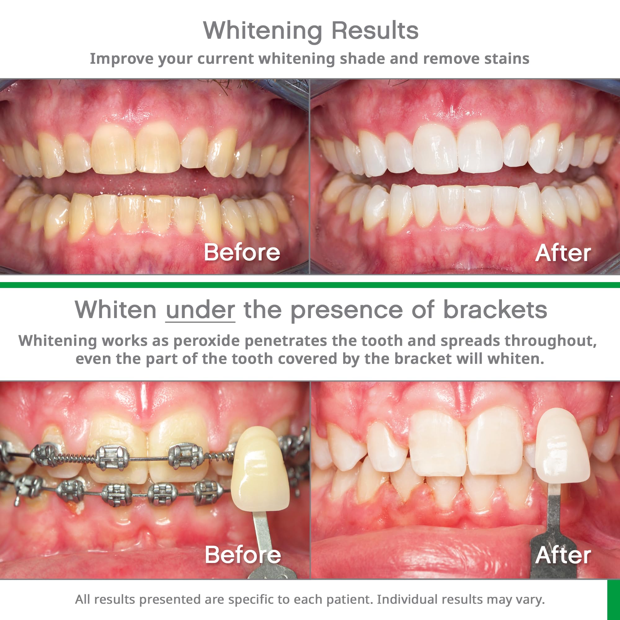 Foto 4 pulgar | Kit de Blanqueamiento Dental Opalescence Go con Peróxido de Hidrógeno- Venta Internacional
