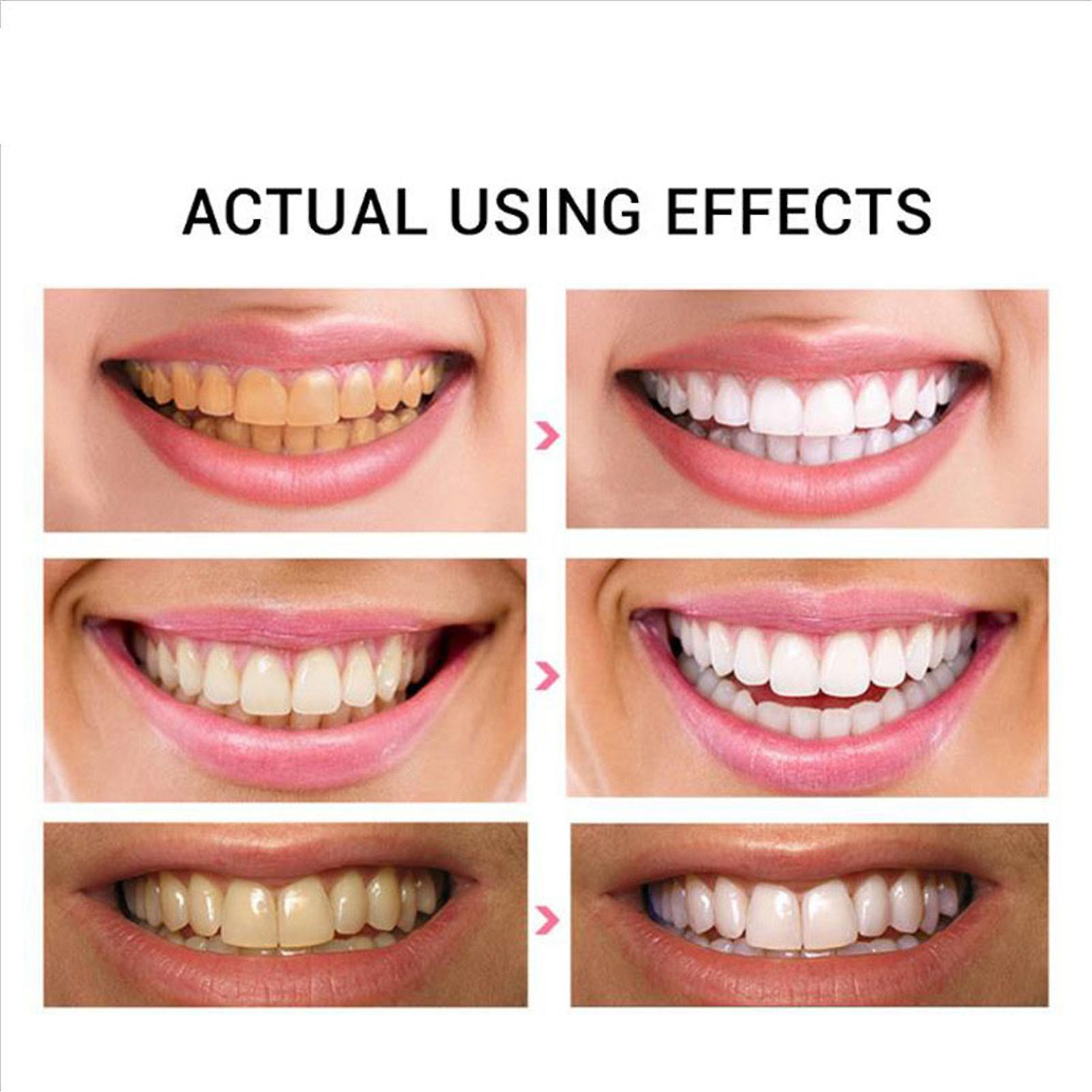 Foto 4 pulgar | Pasta De Dientes Huoguo Daily Para Eliminar Las Manchas Dentales Y Blanquear - Venta Internacional.