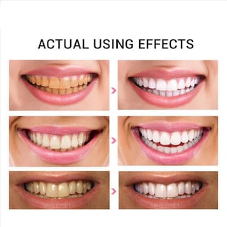 Foto 3 | Pasta De Dientes Huoguo Daily Para Eliminar Las Manchas Dentales Y Blanquear - Venta Internacional.