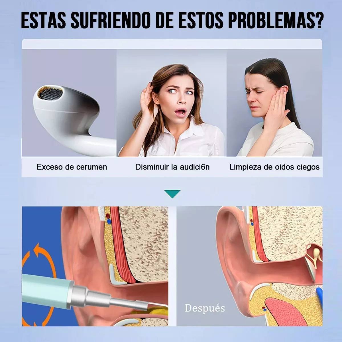Foto 4 pulgar | Limpiador Oídos Cámara Quita Cerilla Inteligente Eo Safe Imports Esi-10367 Azul